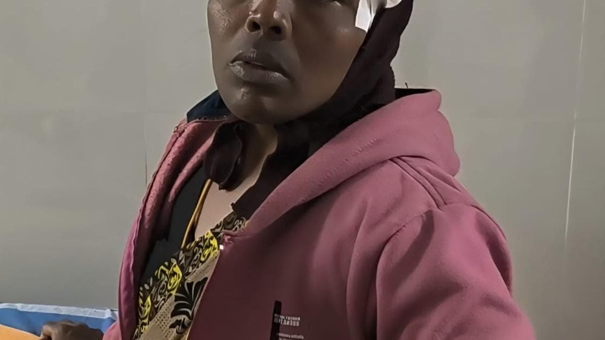 Woman attender injured after roof plastering peeled off at Tirupattur GH